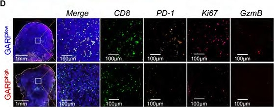 Fig.6.D showing Immunohistochemistry-immunofluorescence in a Mus musculus (House mouse) sample from the publication: Glucocorticoids Unleash Immune-dependent Melanoma Control through Inhibition of the GARP/TGFβ Axis.