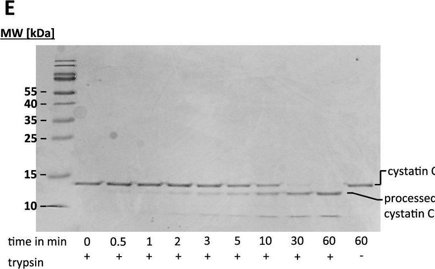 Fig.3.E showing Western Blotting from the publication: Biochemical analyses of cystatin-C dimers and cathepsin-B reveals a trypsin-driven feedback mechanism in acute pancreatitis.