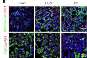 Fig.1.E showing Immunohistochemistry-immunofluorescence from the publication: Inhibition of epigenetic regulator UHRF1 attenuates renal fibrosis and retains transcription factor Krüppel-like factor 15 expression.