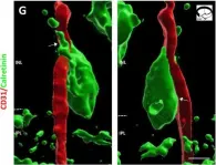 Fig.5.G showing Immunohistochemistry in a Mus musculus (House mouse) sample from the publication: In Utero Alcohol Exposure Impairs Retinal Angiogenesis and the Microvessel-Associated Positioning of Calretinin Interneurons.