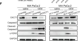 Fig.3.F showing Western Blotting from the publication: OXCT1 Enhances Gemcitabine Resistance Through NF-κB Pathway in Pancreatic Ductal Adenocarcinoma.