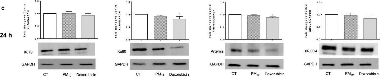 Fig.4.C showing Western Blotting in a Homo sapiens (Human) sample from the publication: Airborne PM10 Decreases Ku80 Expression and Ku70-Ku80 Heterodimer Levels of the Non-Homologous End Joining Repair Pathway in Lung Epithelial Cells.