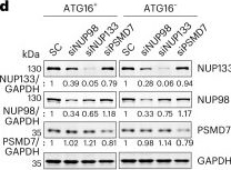Fig.1.D showing Western Blotting from the publication: Nuclear proteasomes buffer cytoplasmic proteins during autophagy compromise.