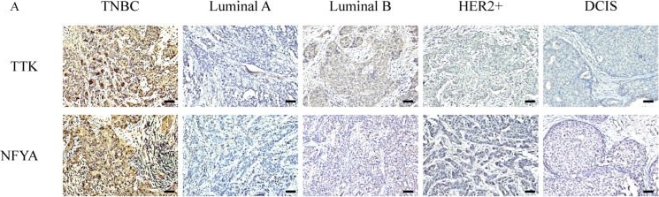 Fig.3.A showing Immunohistochemistry in a Homo sapiens (Human) sample from the publication: NFYA-Mediated TTK Up-Regulation Drives Fast Cell Cycle Progression and Its Inhibition Leads to Mitotic Catastrophe in Triple Negative Breast Cancer.