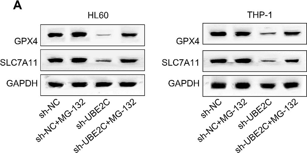 Fig.4.A showing Western Blotting from the publication: UBE2C promotes the proliferation of acute myeloid leukemia cells through PI3K/AKT activation.