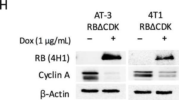 Fig.1.H showing Western Blotting in a Mus musculus (House mouse) sample from the publication: Intrinsic RB activation induces tumoral and stromal anti-tumor responses that limit triple-negative breast cancer.