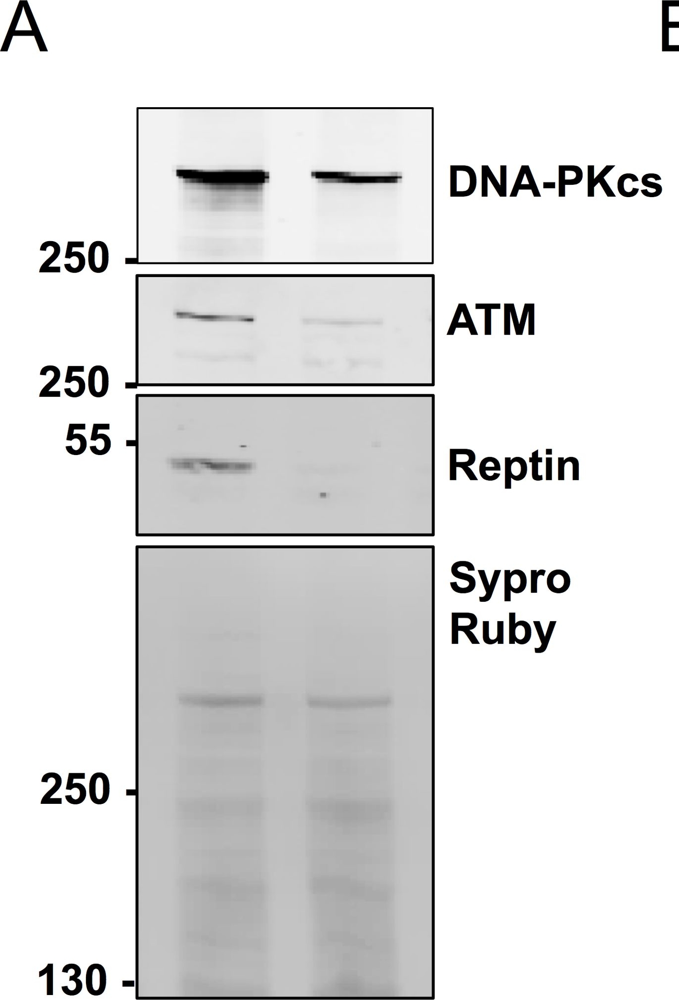 Fig.5.A showing Western Blotting in a Homo sapiens (Human) sample from the publication: Reptin regulates DNA double strand breaks repair in human hepatocellular carcinoma.