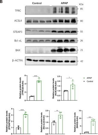 Fig.5.B showing Western Blotting from the publication: A multi-omics landscape of programmed cell death in acetaminophen-induced acute kidney injury.