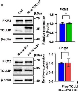 Fig.5.H showing Western Blotting in a Mus musculus (House mouse) sample from the publication: TOLLIP Inhibits Psoriasis Progression via Suppressing PKM2-Mediated Glycolysis in Keratinocytes.