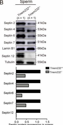 Fig.4.B showing Western Blotting from the publication: TMEM232 is required for the formation of sperm flagellum and male fertility in mice.