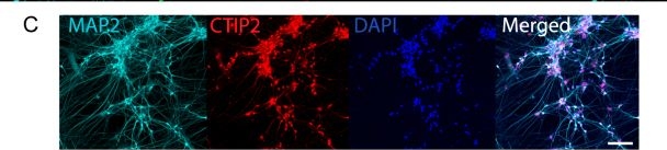 Fig.1.C showing Immunohistochemistry-immunofluorescence in a Homo sapiens (Human) sample from the publication: T3 enhances neuronal activity in an induced pluripotent stem cell derived model of early human brain development.