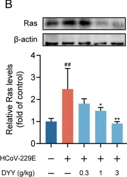 Fig.6.B showing Western Blotting in a Mus musculus (House mouse) sample from the publication: Dayuan Yin alleviates symptoms of HCoV-229E-induced pneumonia and modulates the Ras/Raf1/MEK/ERK pathway.