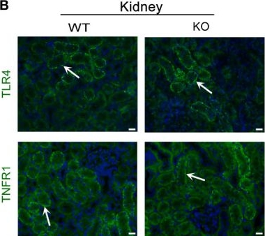 Fig.8.B showing Immunohistochemistry-immunofluorescence in a Mus musculus (House mouse) sample from the publication: Regulatory roles of SP-A and exosomes in pneumonia-induced acute lung and kidney injuries.