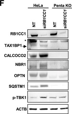 Fig.2.F showing Western Blotting in a Homo sapiens (Human) sample from the publication: AZI2 mediates TBK1 activation at unresolved selective autophagy cargo receptor complexes with implications for CD8 T-cell infiltration in breast cancer.