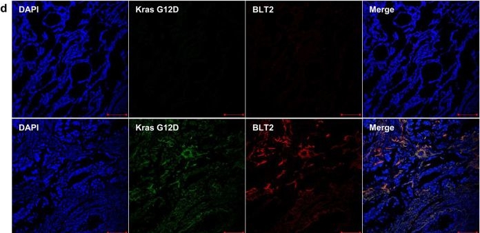 Fig.5.D showing Immunohistochemistry-immunofluorescence from the publication: Leukotriene B4 receptor-2 contributes to KRAS-driven lung tumor formation by promoting interleukin-6-mediated inflammation.