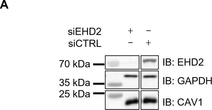 Fig.1.A showing Western Blotting in a Homo sapiens (Human) sample from the publication: Caveolin-1 protects endothelial cells from extensive expansion of transcellular tunnel by stiffening the plasma membrane.