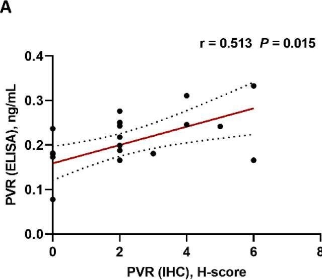 Fig.3.A showing Enzyme-linked immunosorbent assay from the publication: PVR (CD155) Expression as a Potential Prognostic Marker in Multiple Myeloma.