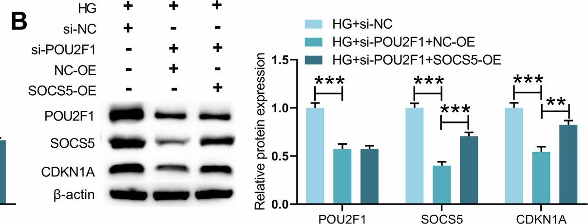 Fig.6.B showing Western Blotting from the publication: Mechanistic insights into SOCS5-related DNA damage and cellular senescence in diabetic retinopathy.