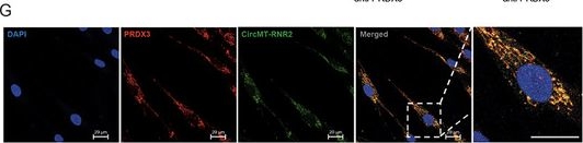 Fig.4.G showing Immunocytochemistry-immunofluorescence in a Homo sapiens (Human) sample from the publication: Mitochondrial CircRNA CircMT-RNR2 Safeguards Antioxidant Defense to Support Fibroblast Functions in Wound Repair.
