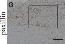 Paxillin (D9G12) Rabbit Monoclonal Antibody | Cell Signaling