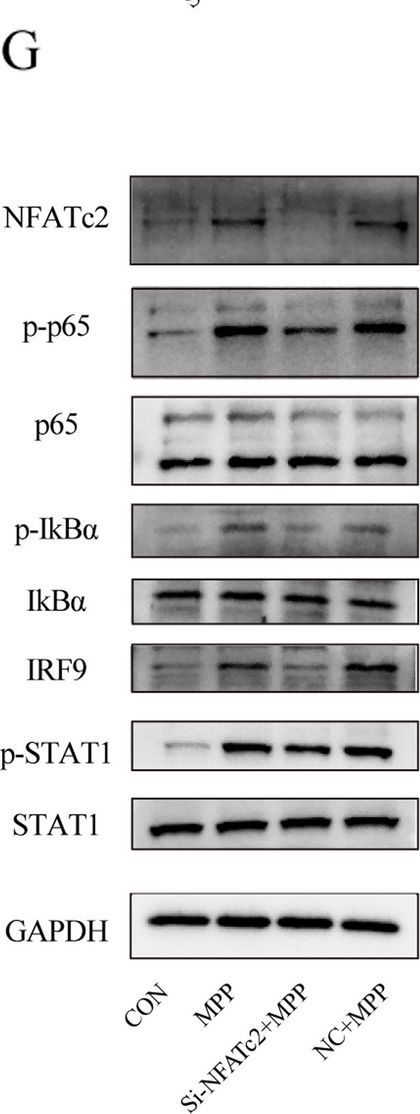 Fig.9.G showing Western Blotting from the publication: Single cell analysis reveals the roles and regulatory mechanisms of type-I interferons in Parkinson's disease.