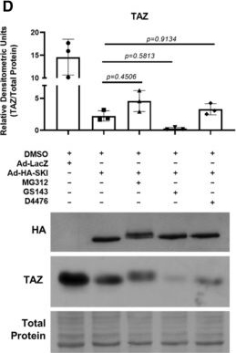 Fig.5.D showing Western Blotting from the publication: SKI activates the Hippo pathway via LIMD1 to inhibit cardiac fibroblast activation.