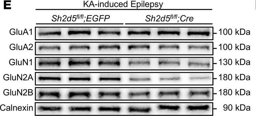 Fig.5.E showing Western Blotting from the publication: Deletion of SH2D5 alleviates epileptic seizures and NMDAR expression via autophagic degradation of STAT1.