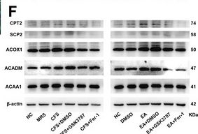 Fig.6.F showing Western Blotting in a Homo sapiens (Human) sample from the publication: Erucic Acid, Derived by Lactobacillus Crispatus, Induces Ferroptosis in Cervical Cancer Organoids Through the PPAR-δ Signaling Pathway.