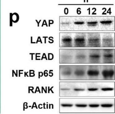 Fig.5.P showing Western Blotting in a Rattus norvegicus (Rat) sample from the publication: Mechanosensor YAP mediates bone remodeling via NF-κB p65 induced osteoclastogenesis during orthodontic tooth movement.