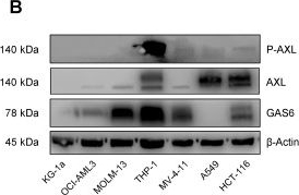 Fig.2.B showing Western Blotting from the publication: AXL-specific single domain antibodies show diagnostic potential and anti-tumor activity in Acute Myeloid Leukemia.