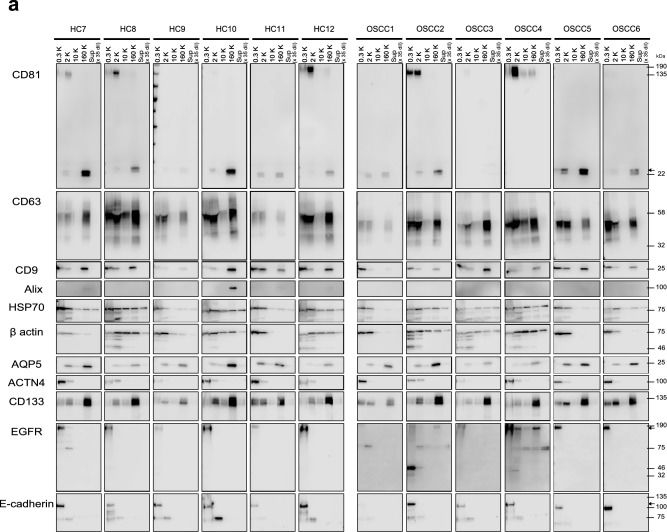 Fig.3.A showing Western Blotting from the publication: Pentapartite fractionation of particles in oral fluids by differential centrifugation.