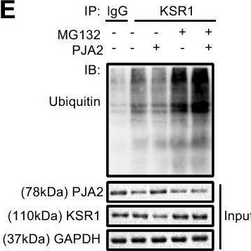 Fig.5.E showing Western Blotting from the publication: ELK4 promotes the development of gastric cancer by inducing M2 polarization of macrophages through regulation of the KDM5A-PJA2-KSR1 axis.