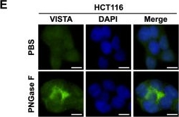 Fig.6.E showing Immunocytochemistry-immunofluorescence in a Homo sapiens (Human) sample from the publication: YAP/TEAD4/SP1-induced VISTA expression as a tumor cell-intrinsic mechanism of immunosuppression in colorectal cancer.