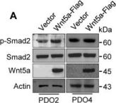 sevenbutterfly 　3点まとめ Phospho-SMAD2 (Ser465/Ser467) (E8F3R) Rabbit mAb | Cell