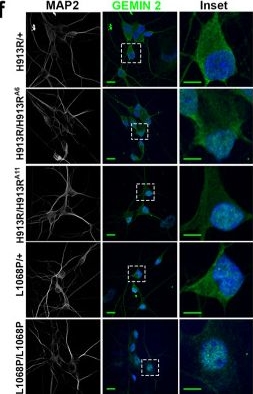 Fig.2.F showing Immunocytochemistry-immunofluorescence from the publication: Loss of function mutations in GEMIN5 cause a neurodevelopmental disorder.