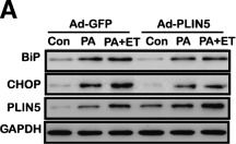 Perilipin5 protects against lipotoxicity and alleviates endoplasmic reticulum stress in pancreatic β-cells.