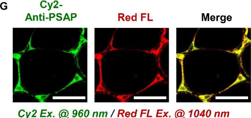 Fig.1.G showing Immunocytochemistry-immunofluorescence in a Mus musculus (House mouse) sample from the publication: Label-free optical metabolic imaging of adipose tissues for prediabetes diagnosis.