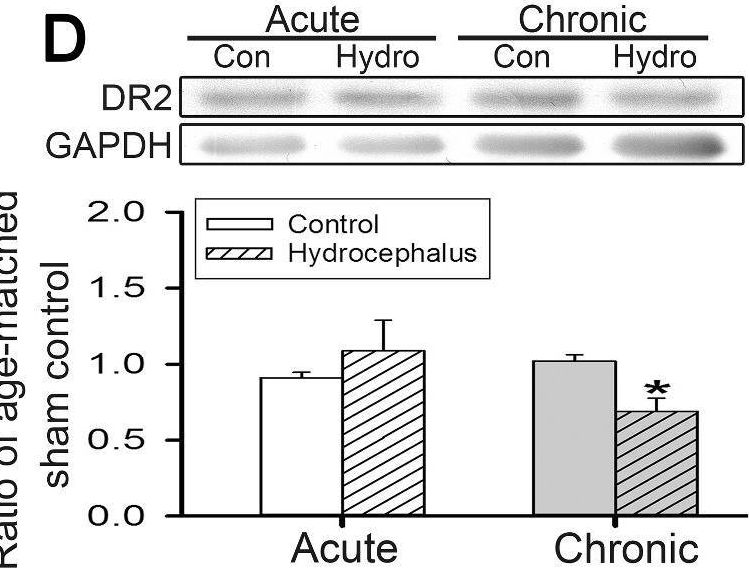 Fig.7.D showing Western Blotting in a Rattus norvegicus (Rat) sample from the publication: Modulation of striatal glutamatergic, dopaminergic and cholinergic neurotransmission pathways concomitant with motor disturbance in rats with kaolin-induced hydrocephalus.