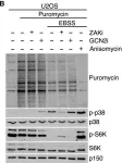 Fig.2.B showing Western Blotting from the publication: Ribosome stalling is a signal for metabolic regulation by the ribotoxic stress response.