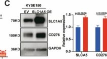 Fig.4.C showing Western Blotting in a Homo sapiens (Human) sample from the publication: Glutamine transporter SLC1A5 inhibits autophagy-mediated CD276 degradation to promote esophageal cancer progression.