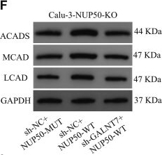 Fig.5.F showing Western Blotting from the publication: GALNT7-induced O-glycosylation of NUP50 activates fatty acid β-oxidation to promote lung adenocarcinoma metastasis.