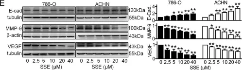 Fig.2.E showing Western Blotting from the publication: Sodium selenite inhibits proliferation and metastasis through ROS-mediated NF-κB signaling in renal cell carcinoma.