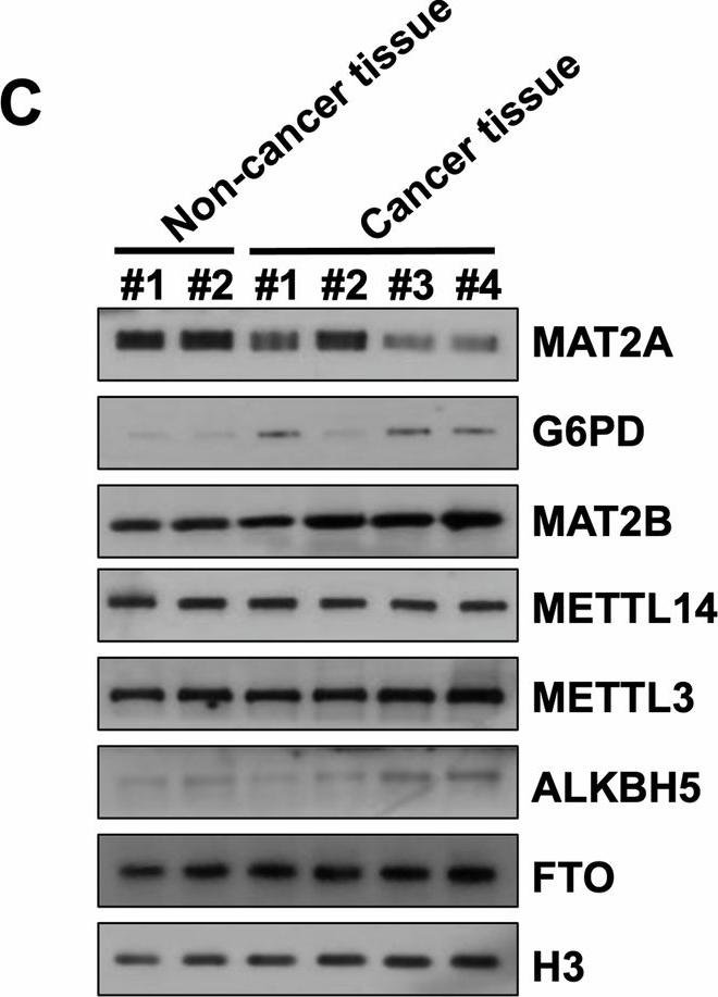 Fig.5.C showing Western Blotting from the publication: MAT2B regulates the protein level of MAT2A to preserve RNA N6-methyladenosine.