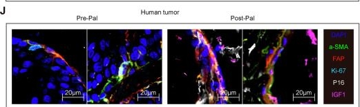 Fig.5.J showing Immunohistochemistry-immunofluorescence from the publication: CSF1R inhibitors mitigate CDK4/6 inhibitor-induced immunosuppression to increase antitumor immunity in HR+/HER2- breast cancer.