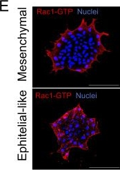 Fig.6.E showing Immunocytochemistry-immunofluorescence in a Xenopus laevis (African clawed frog) sample from the publication: Force coordination distinguishes epithelial and mesenchymal modes of collective chemotaxis.