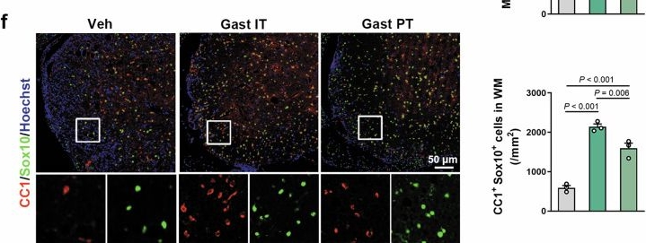 Fig.6.F showing Immunohistochemistry-immunofluorescence from the publication: Gastrodin promotes CNS myelinogenesis and alleviates demyelinating injury by activating the PI3K/AKT/mTOR signaling.