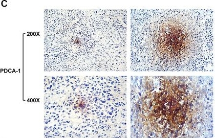 Fig.6.C showing Immunohistochemistry in a Mus musculus (House mouse) sample from the publication: A Novel C Type CpG Oligodeoxynucleotide Exhibits Immunostimulatory Activity In Vitro and Enhances Antitumor Effect In Vivo.