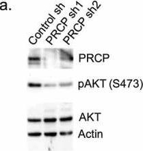 Fig.2.A showing Western Blotting from the publication: Prolylcarboxypeptidase promotes IGF1R/HER3 signaling and is a potential target to improve endocrine therapy response in estrogen receptor positive breast cancer.