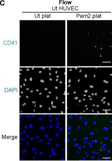 Fig.6.C showing Immunocytochemistry-immunofluorescence from the publication: The Toll-Like Receptor 2 Ligand Pam2CSK4 Activates Platelet Nuclear Factor-κB and Bruton's Tyrosine Kinase Signaling to Promote Platelet-Endothelial Cell Interactions.