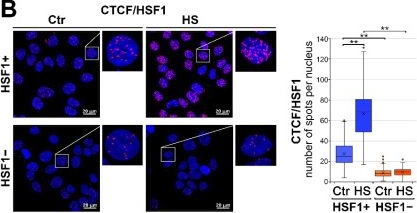 Fig.3.B showing Immunocytochemistry-immunofluorescence in a Homo sapiens (Human) sample from the publication: HSF1 Can Prevent Inflammation following Heat Shock by Inhibiting the Excessive Activation of the ATF3 and JUN&amp;FOS Genes.